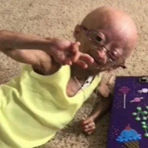 Adalia Rose (2006 - 2022) (Facebook Star)