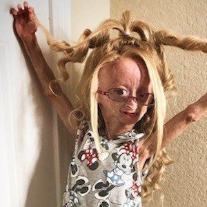 Adalia Rose (2006 - 2022) (Estrela Do Facebook)