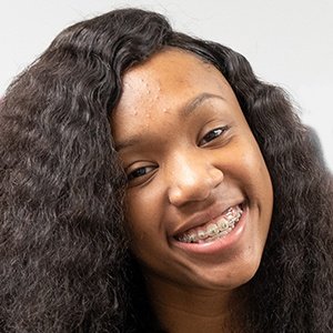 Brace Face Laii, 21 (Instagram Star)
