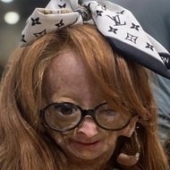 Adalia Rose (2006 - 2022) (Facebook Star)