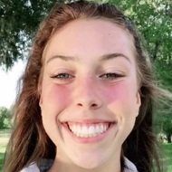 Cassidy Patterson, 22 (TikTok明星)