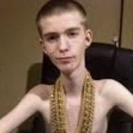 Daddy Long Neck, 24 (Instagram Star)