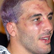 Kurt Pellegrino, 46 (MMA Fighter)