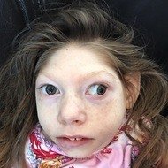 Lola Hartley, 17 (Family Member)