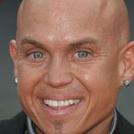 Martin Klebba, 56 (TV Actor)
