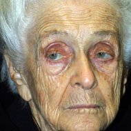 Rita Levi-Montalcini (1909 - 2012) (Biologist)