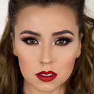 Rose Siard, 37 (Instagram Star)